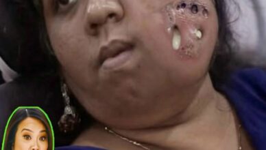 General ANESTHESIA for Face Tumor Removal