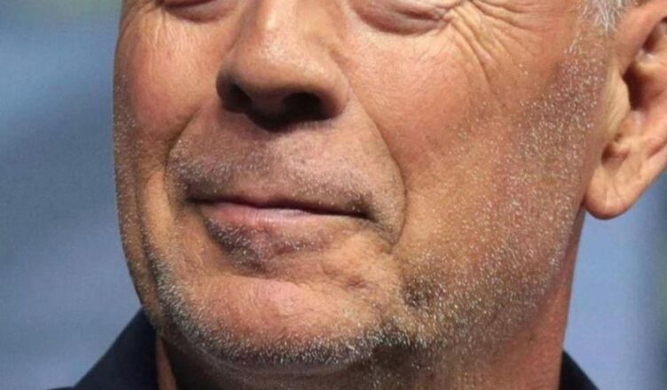 Bruce Willis Battles Dementia as His Family Stays Strong!