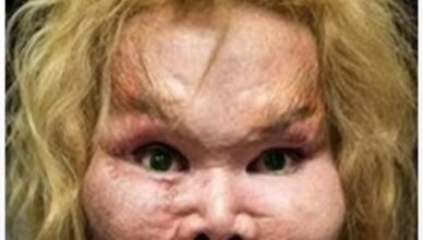Well-known Stars Who Spent Millions Changing Their Looks