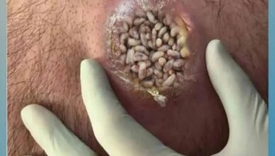 RED DOTS ON YOUR SKIN: CAUSES AND WHAT THEY MIGHT REPRESENTt RED DOTS ON YOUR SKIN: CAUSES AND WHAT THEY MIGHT REPRESENTt