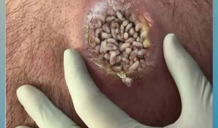 RED DOTS ON YOUR SKIN: CAUSES AND WHAT THEY MIGHT REPRESENTt