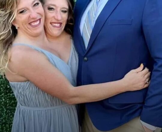 Shocking Twist In Husband’s Marriage to Conjoined Twins