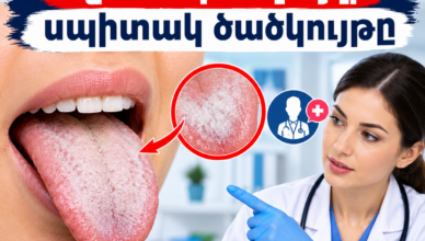 If only you knew what the white coating on the tongue means.