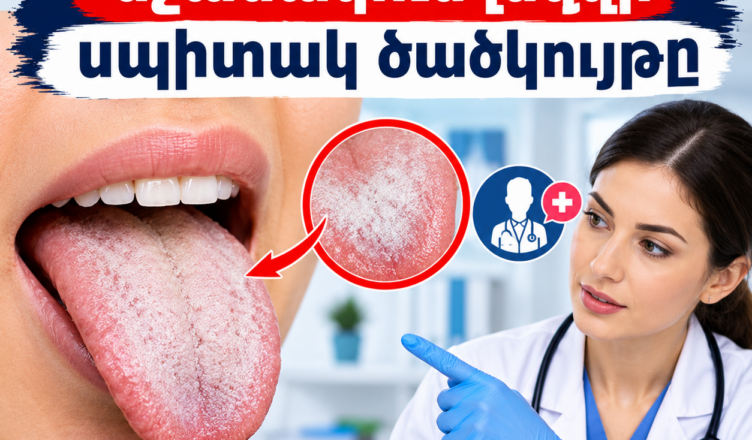 If only you knew what the white coating on the tongue means.