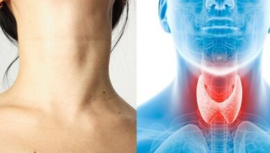 If only you knew how thyroid function affects your health.