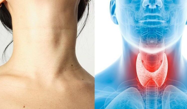 If only you knew how thyroid function affects your health.